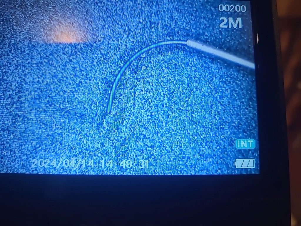 Katalyst Ophthalmology Cataract Manipulator