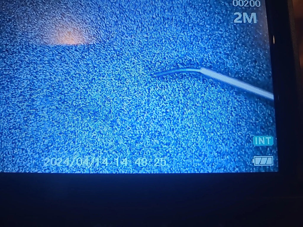 Katalyst Ophthalmology Cataract Manipulator