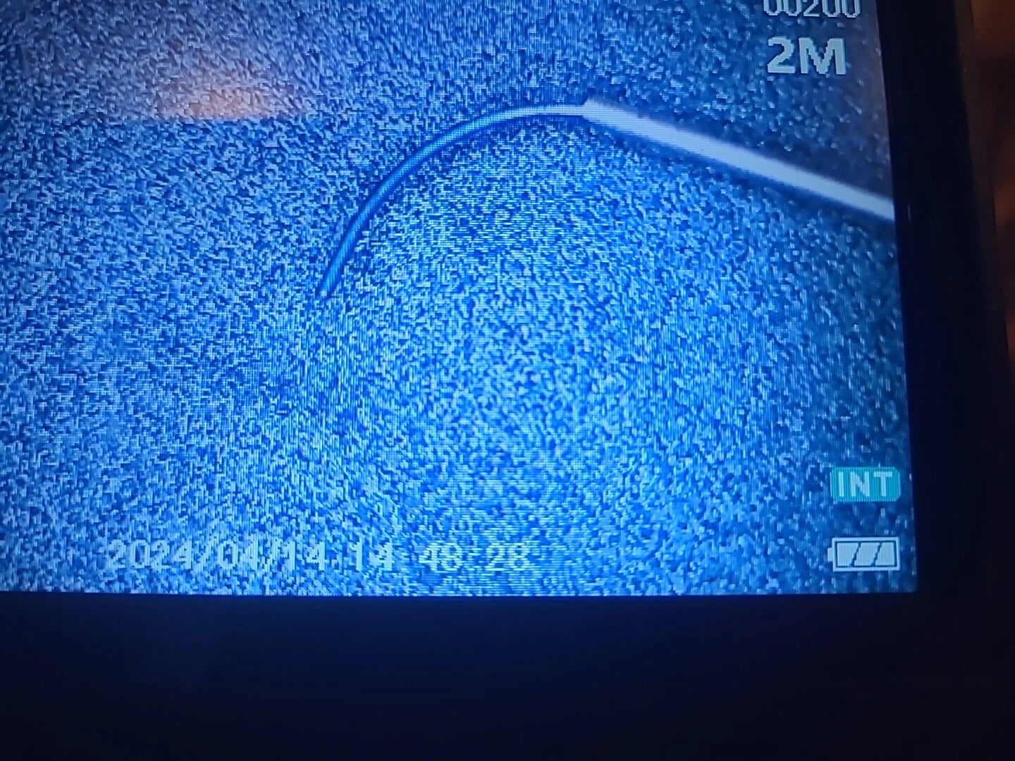 Katalyst Ophthalmology Cataract Manipulator